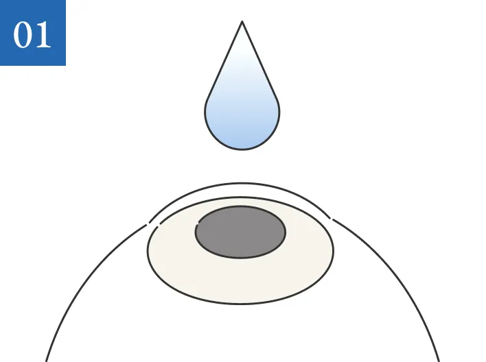 01