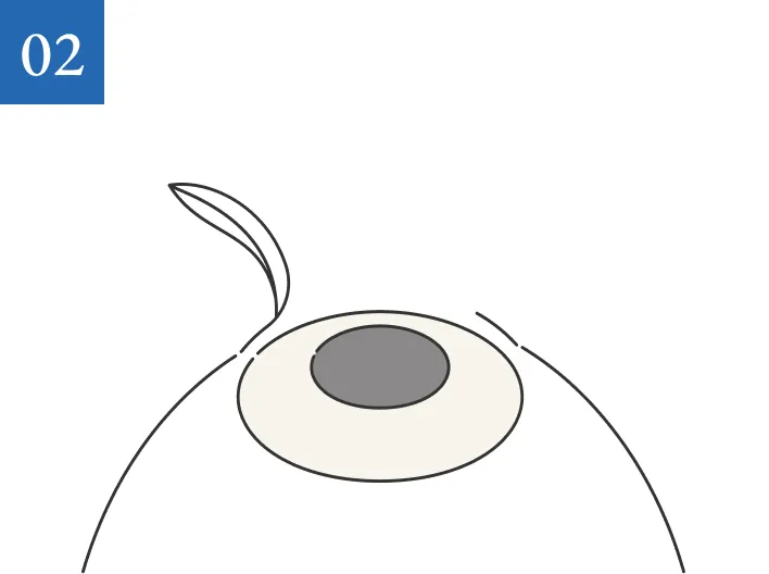 02