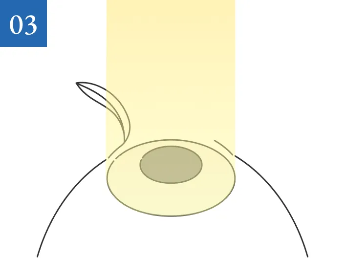 03